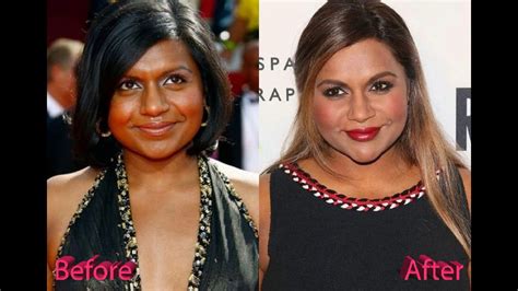 mindy kaling before|Mindy Kaling Plastic Surgery: Transformation Photos,。